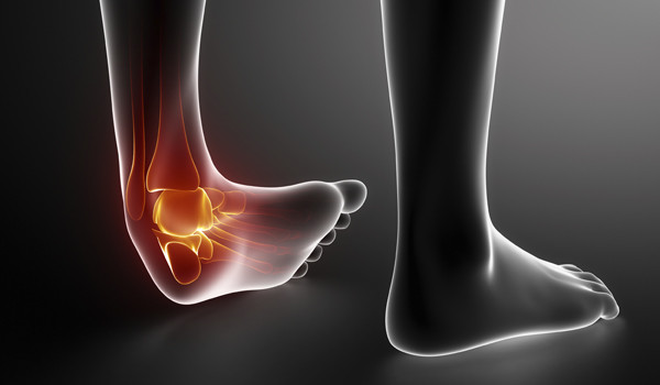 Factors Involved in Recovery Times For Soft Tissue Injuries